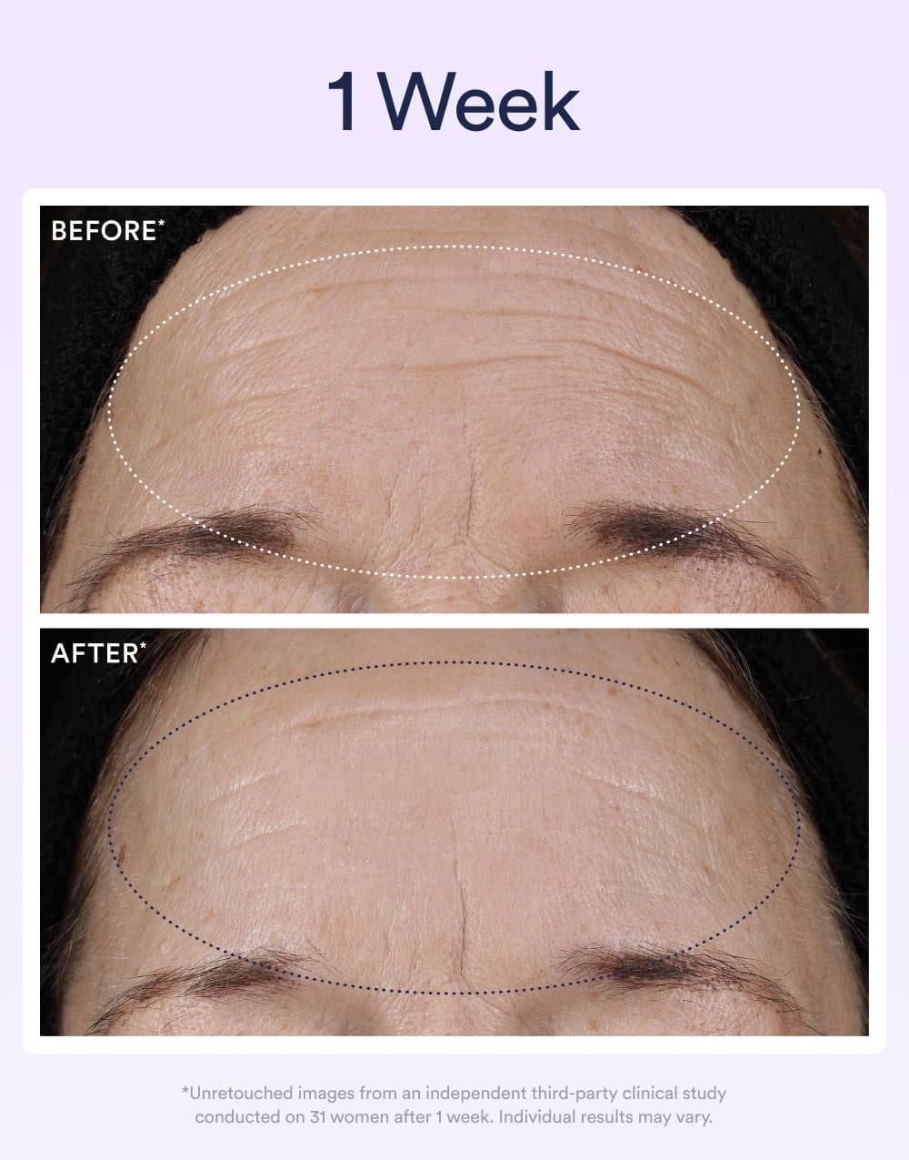 Dream Night Serum with Bio-Retinol - Image 3