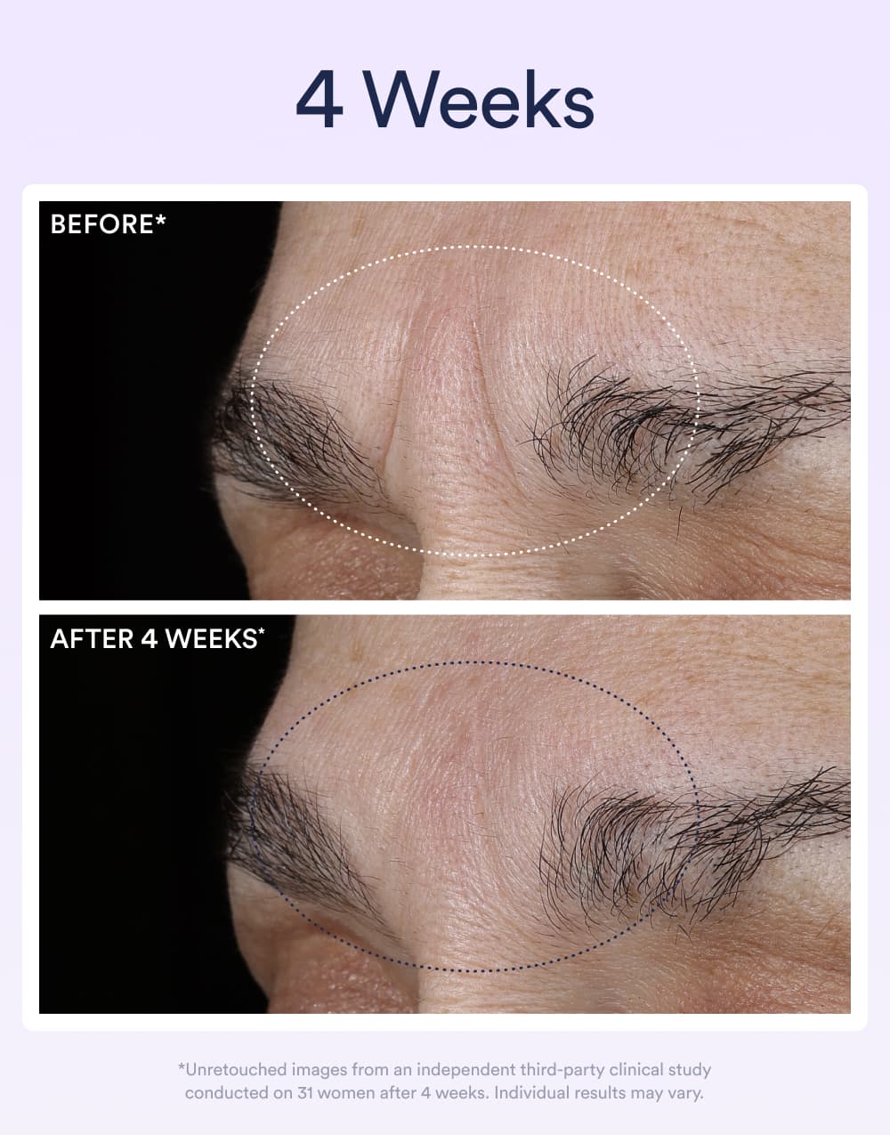 Dream Night Serum with Bio-Retinol - Image 4